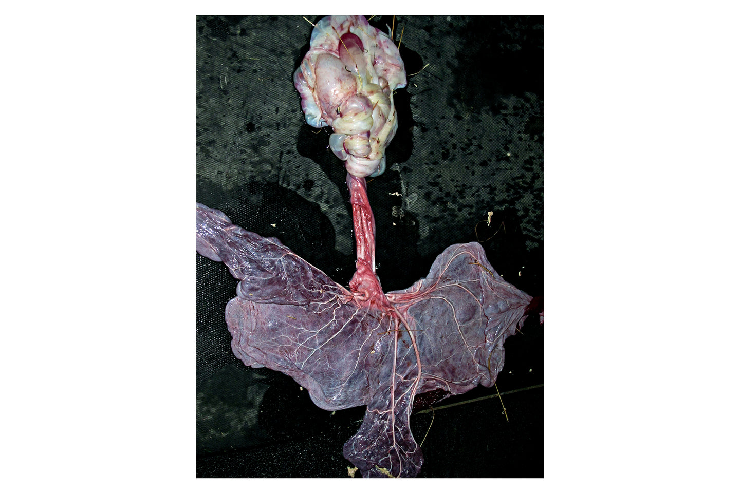 Placenta, 2013